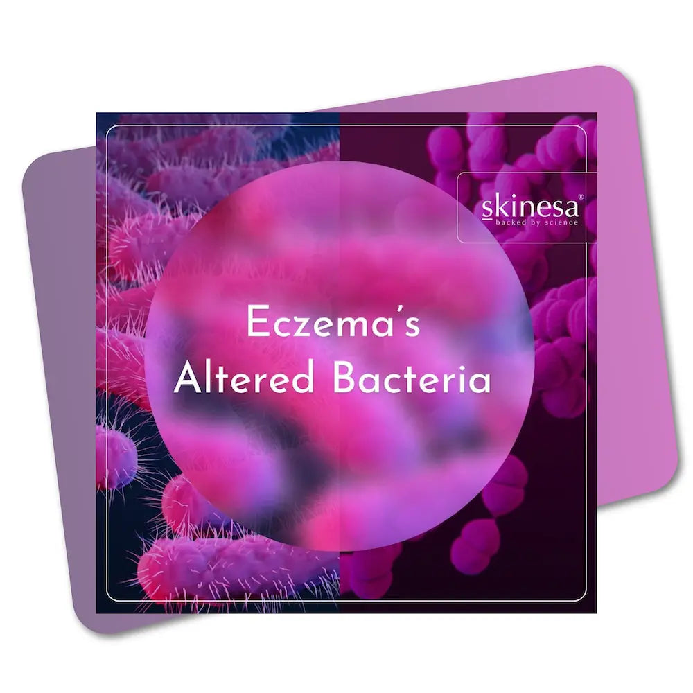 Eczema's Altered Bacteria