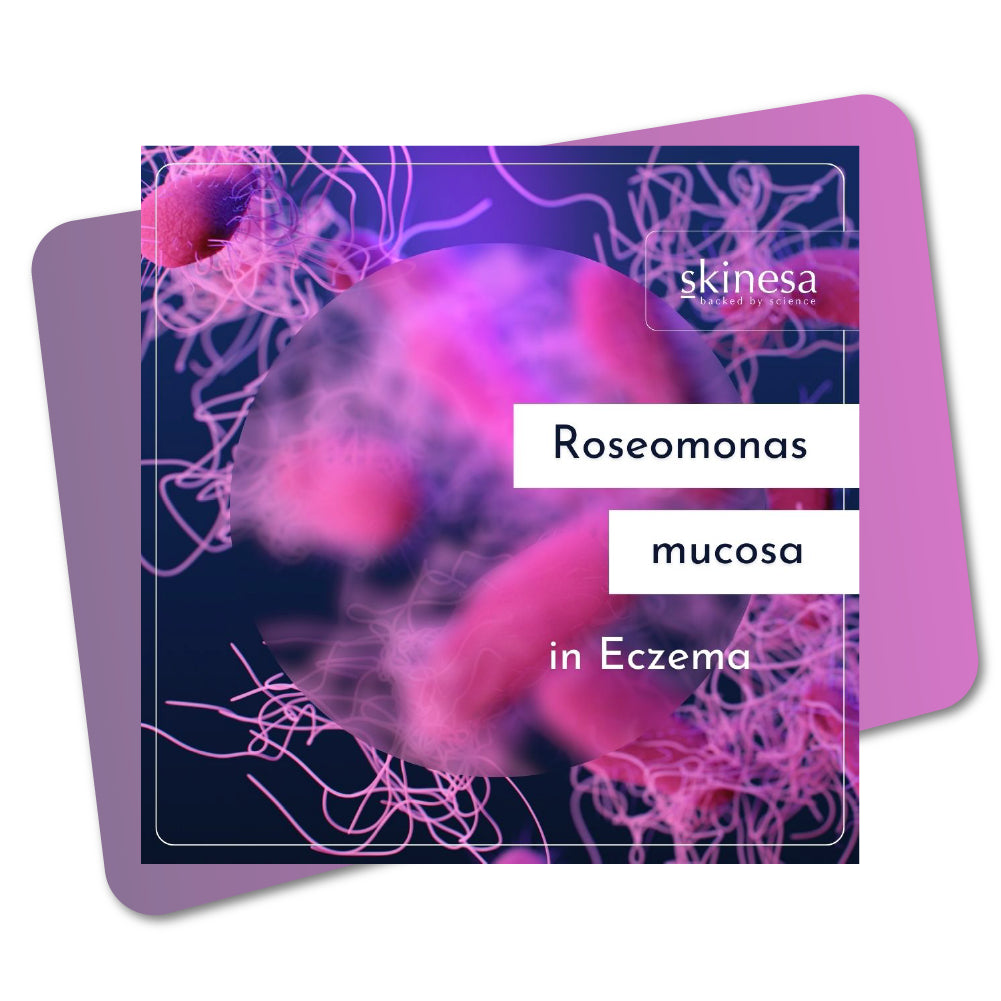 Roseomonas mucosa in Eczema
