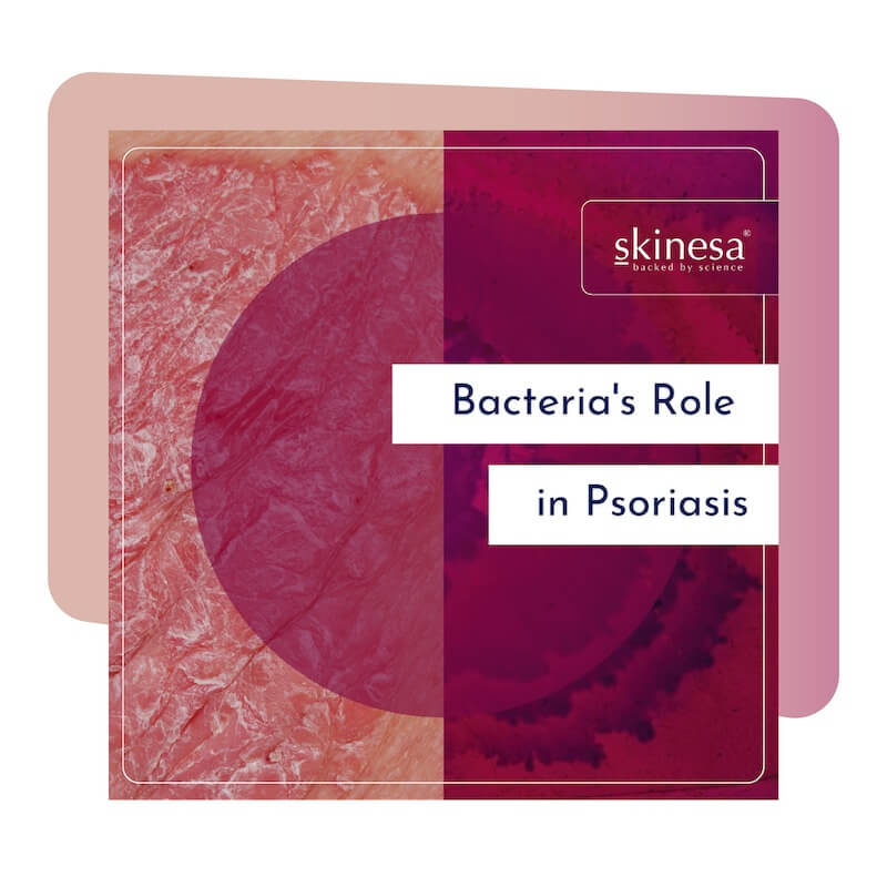 Bacteria's Role in Psoriasis