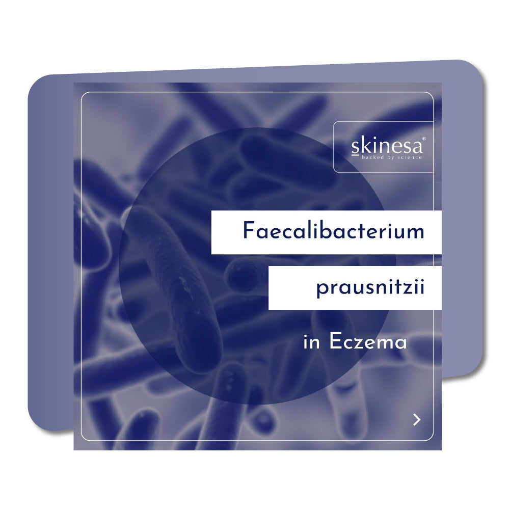 Faecalibacterium prausnitzii in Eczema