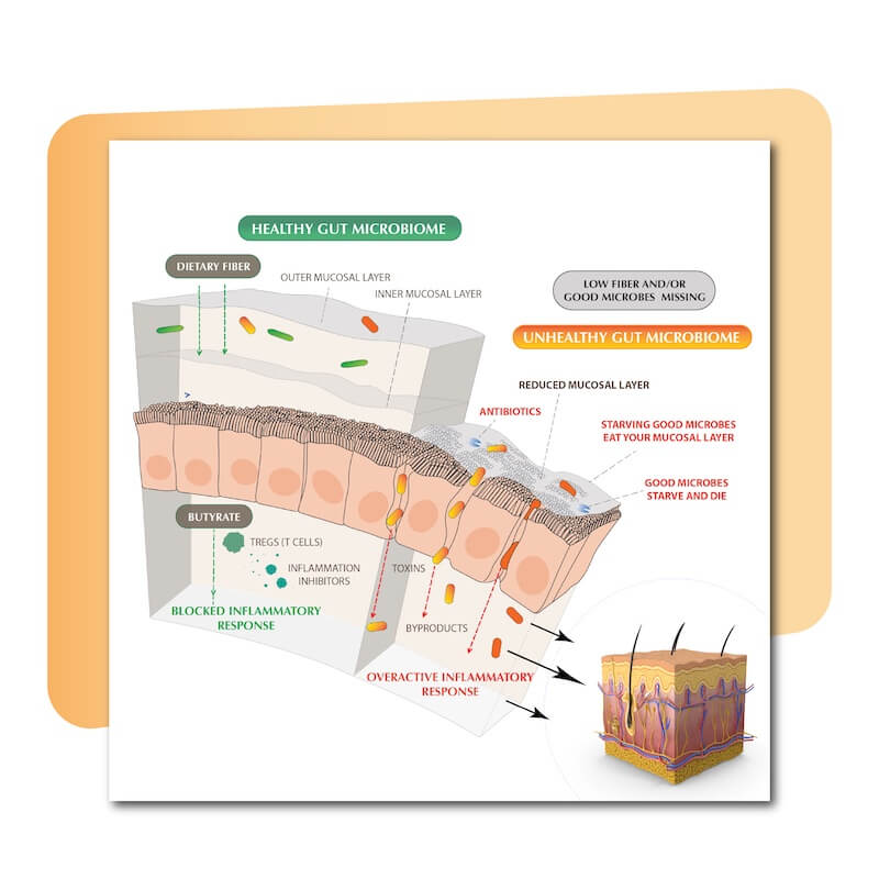 Harnessing the Gut for Better Skin