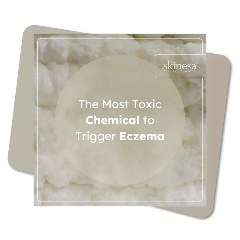 #1 Most Toxic Chemical to Trigger Eczema