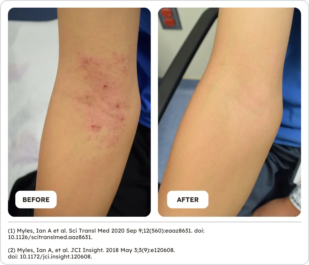 Skin Defencer Defensin - Skinesa